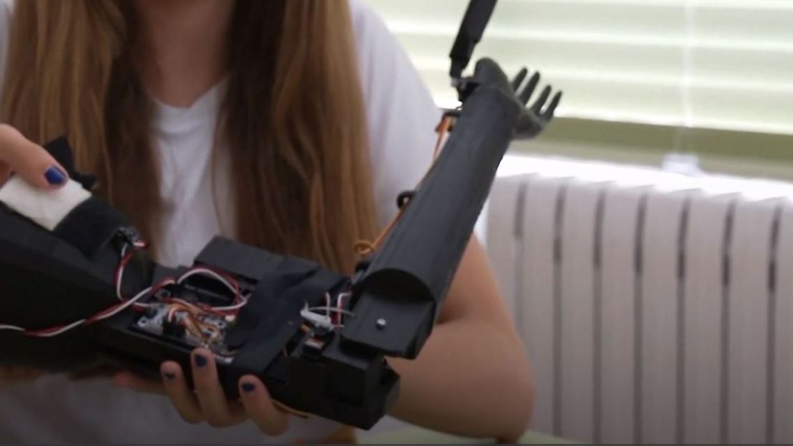 Technologie-Wettbewerb gewonnen: Kinder bauen elektronische Armprothese ...